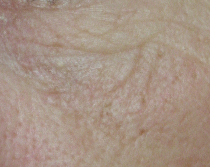 Identifying the different skin types